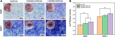 Silicon and gadolinium co-doped hydroxyapatite/PLGA scaffolds with osteoinductive and MRI dual functions